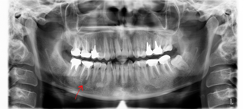 Снимок зубов видное