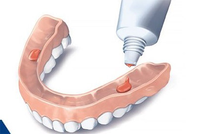 Как производится ремонт зубных протезов