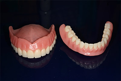 Отсутствие верхних зубов: причины, последствия, лечение