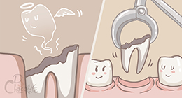 Удаление зубов - Разрушенные зубы