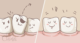 Удаление зубов - Сверхкомплектные зубы